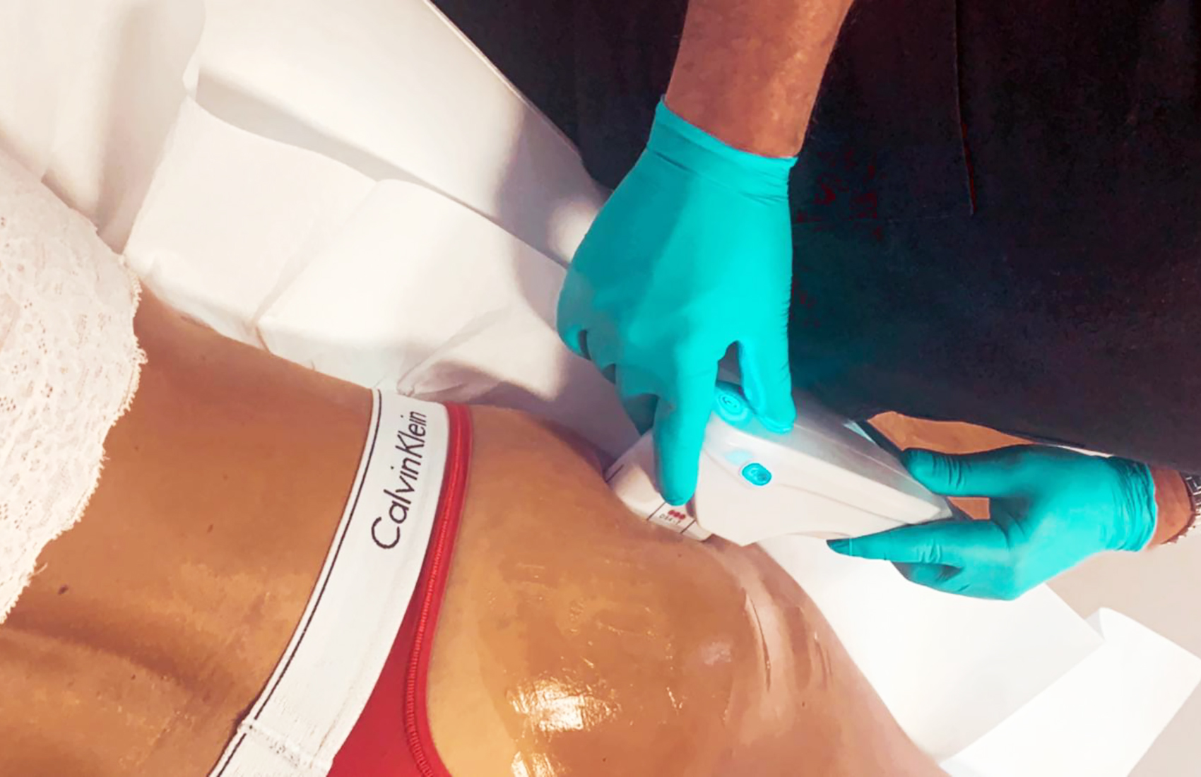 3 sedute lifting medico non chirurgico glutei o braccia -67% di sconto