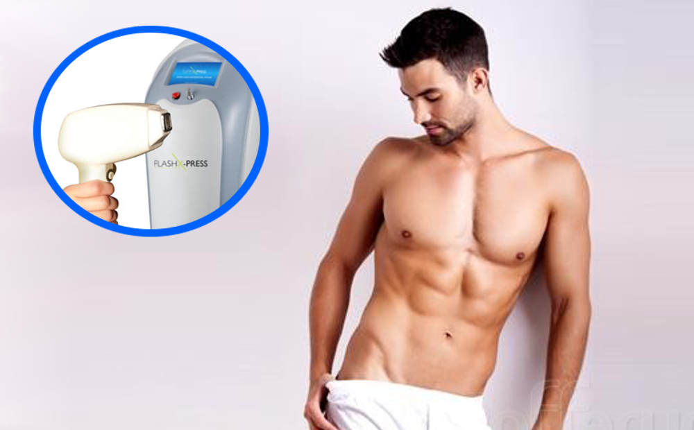 Epilazione laser-diodo: UOMO -82% di sconto
