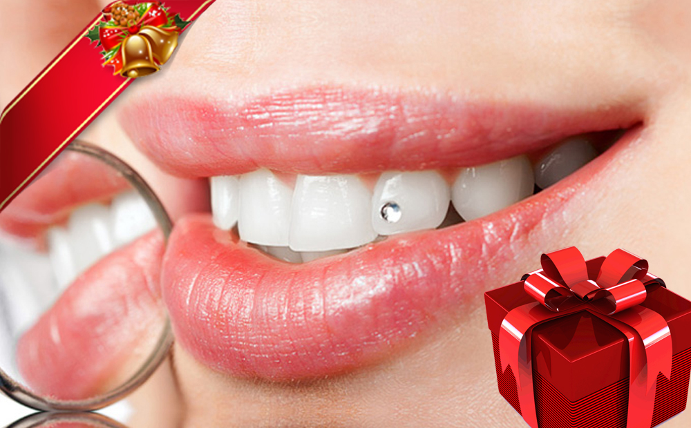 Applicazione brillantino dente "REGALO NATALE" -50% di sconto