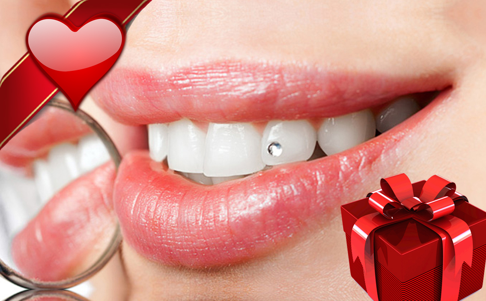 Applicazione brillantino dente "REGALO DI SAN VALENTINO" -50% di sconto