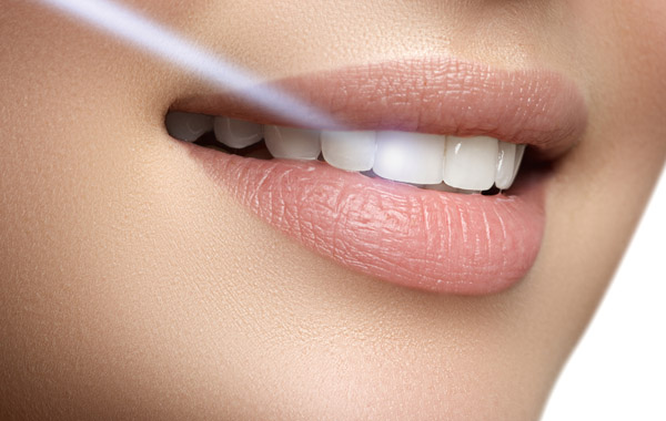 Visita, igiene, SBIANCAMENTO LASER e diagnosi con DIAGNOCAM a Feletto Umberto -73% di sconto